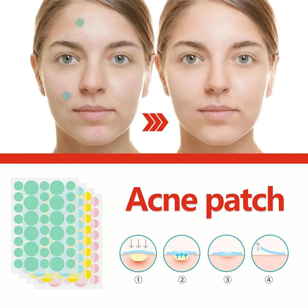 144 pcs Invisible Anti-Acne Patches